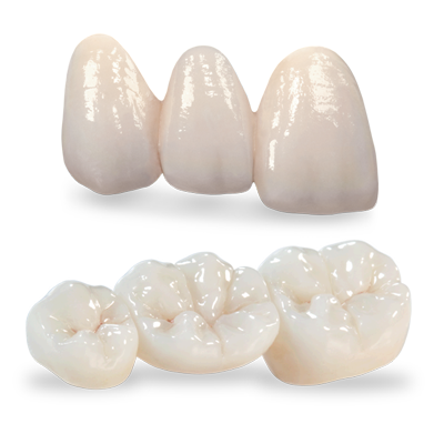 Phục hình Zirconia