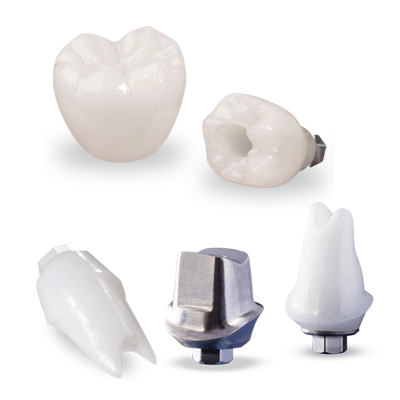 Phục hình răng trên Implant